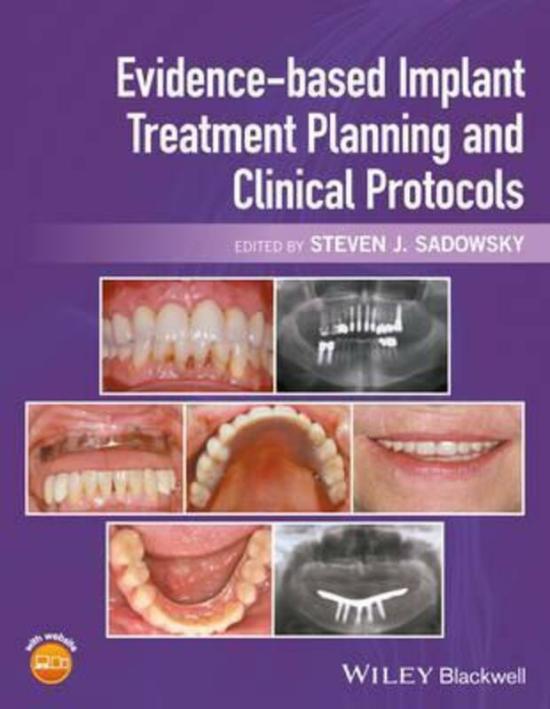 Health, Fitness & Dieting |   Evidence-Based Implant Treatment Planning And Clinical Protocols.Hardcover,By :Sadowsky, Steven J. Health, Fitness & Dieting Health, Fitness & Dieting